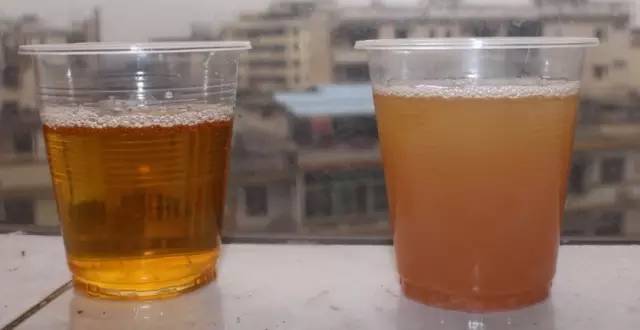 简单教你读懂尿常规|香港大学深圳医院肾内科