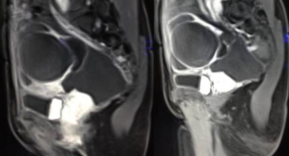 女性下腹疼痛是什么病,女性下腹疼痛的预兆