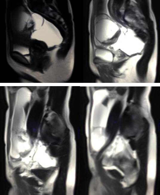 女性下腹疼痛是什么病,女性下腹疼痛的预兆