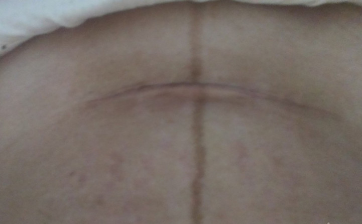 5个月孕妇含泪做引产，医生提醒女性不要像她一样鲁莽！