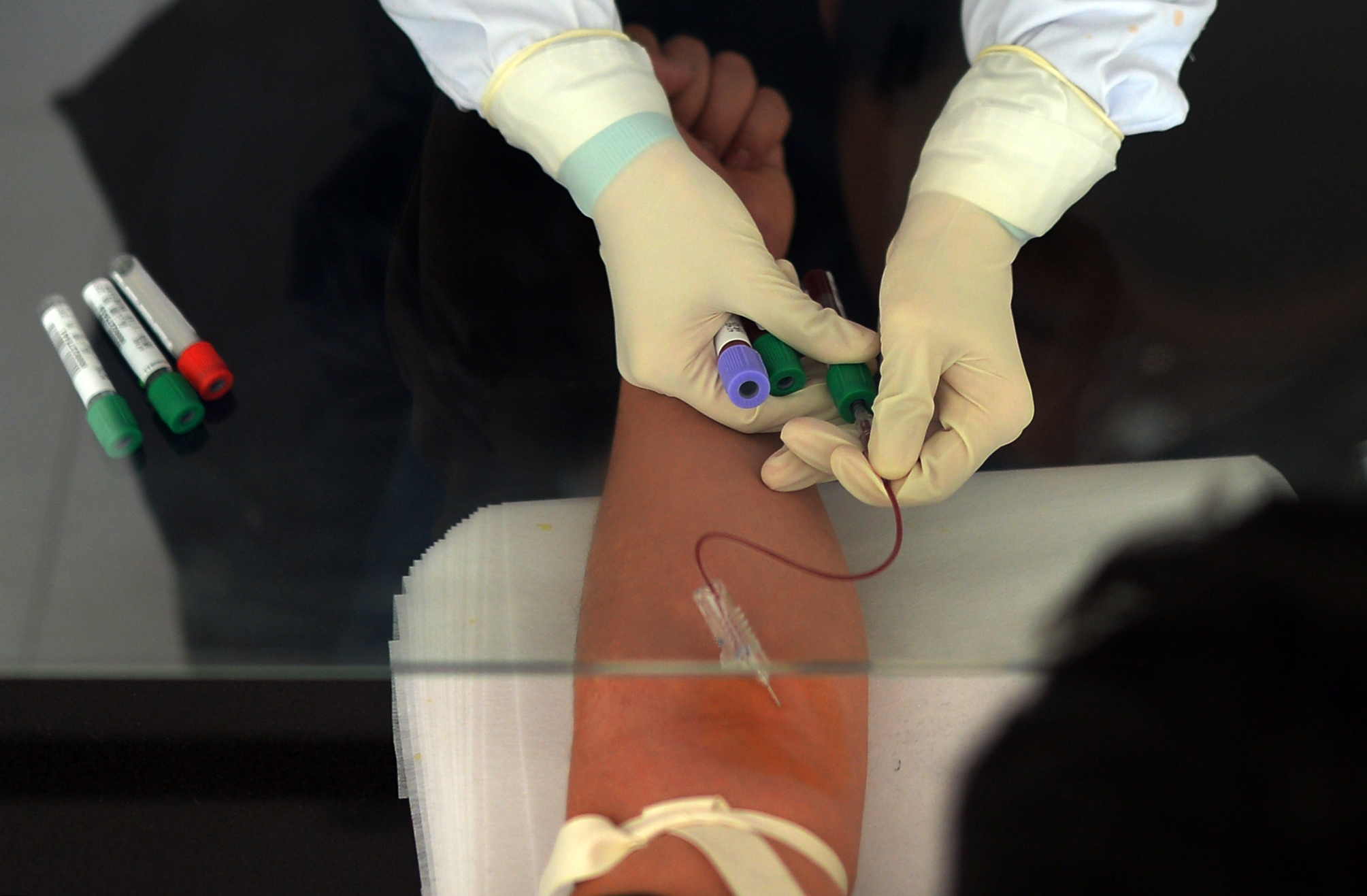 走近医护人员的日常,防治艾滋从年轻开始