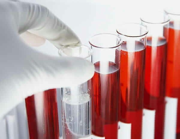 一次教你看懂血常规,手把手教你看血常规报告单