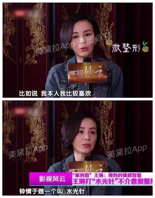 菲洛嘉水光和菲洛嘉营养水光区别,菲洛嘉水光网红