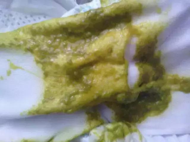 绿色便和黄色便的原因,黑绿色稀便是什么原因