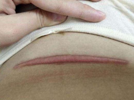 产妇产下6胞胎却遭丈夫抛弃,产妇生下宝宝后却没能抢救过来