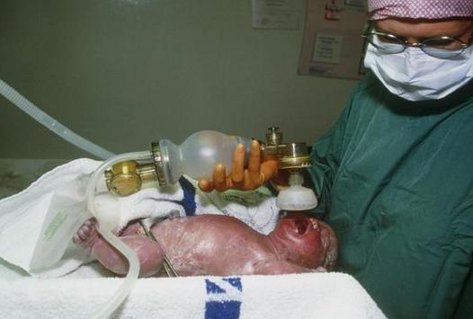 产妇产下6胞胎却遭丈夫抛弃,产妇生下宝宝后却没能抢救过来