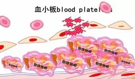 服药后血小板减少停药多久恢复,血小板减少激素怎么减量