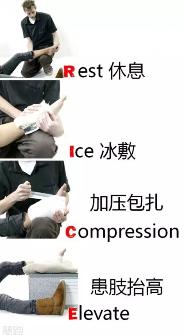 90%的跑友受伤后都用错了外敷药物