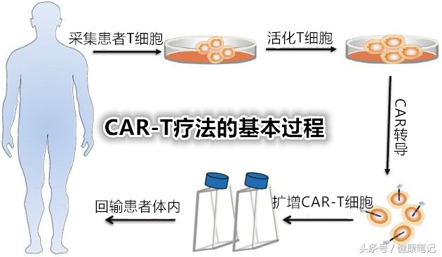 car-t细胞免疫疗法能治愈癌症吗,car-t免疫疗法可以治疗卵巢癌吗