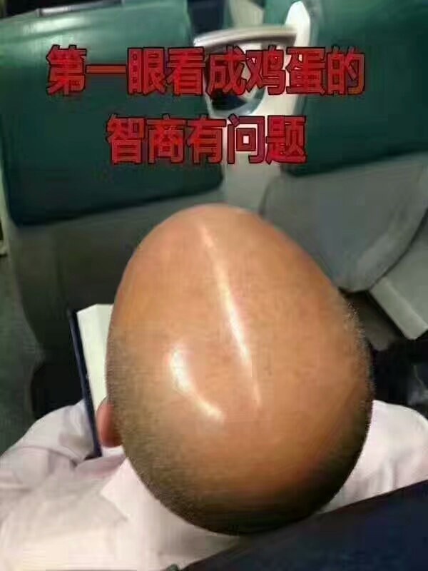 汽车abs故障灯亮怎么处理,大众abs故障灯亮怎么解决