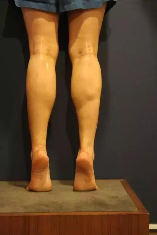 瘦的萝卜腿,萝卜腿还能瘦下来吗