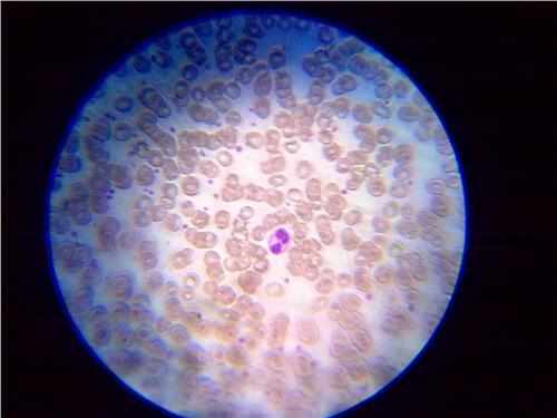 哪些方法预防泌尿感染,孕期尿路感染最快自愈法