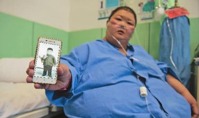 体重指数87接近正常人四倍188.9公斤的他减重手术成功