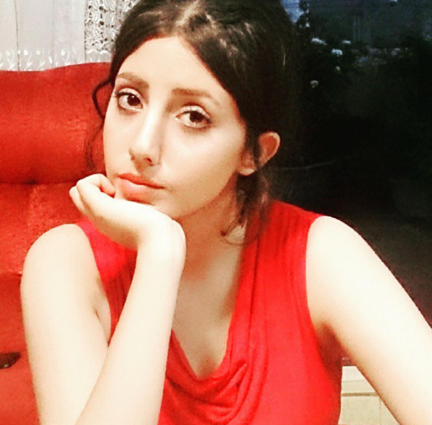 一次整形换来5次痛苦手术,朱莉做了什么手术