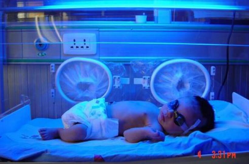 孕妇abo溶血有什么关注的,怀孕溶血是什么血型才会发生的