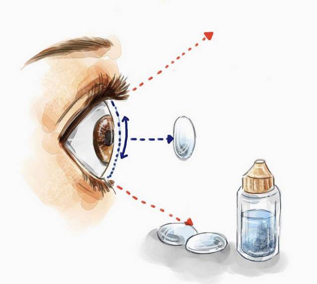 不建议买的美瞳,买美瞳你必须知道的那些事