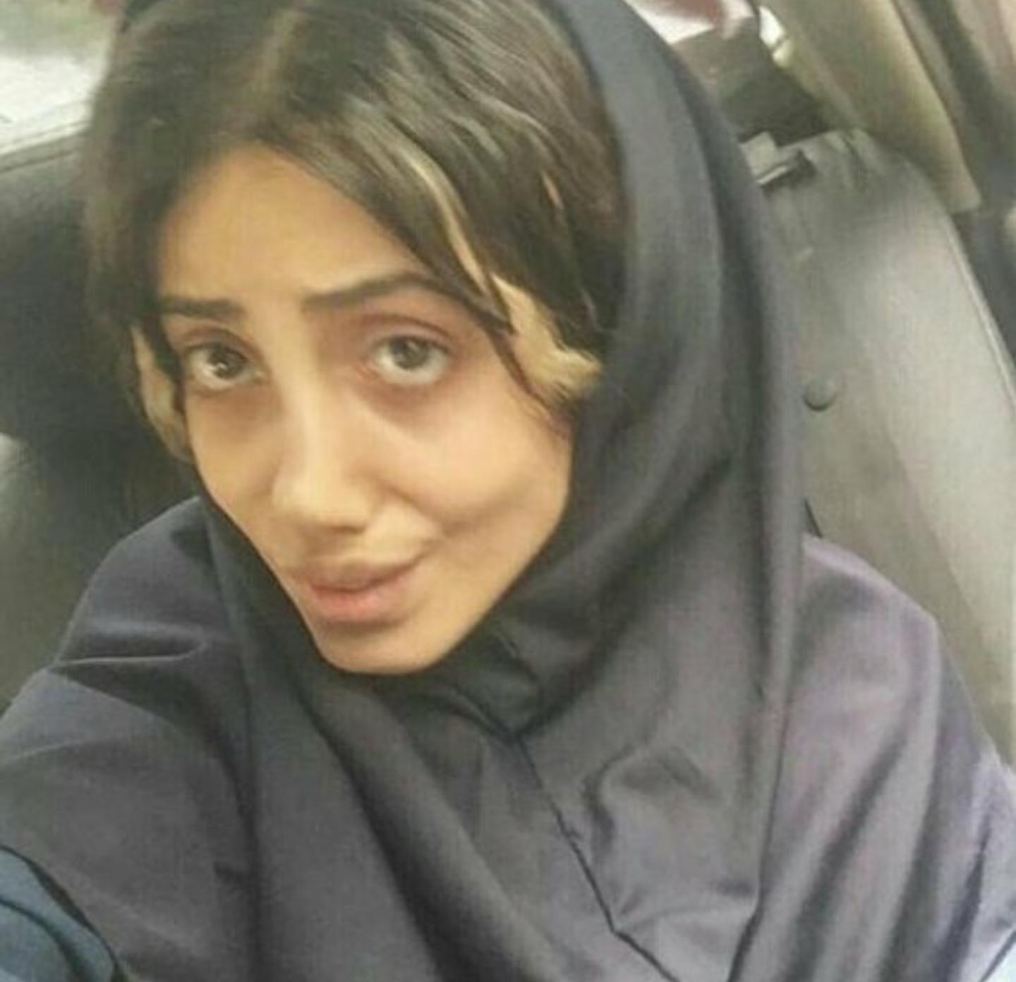 一次整形换来5次痛苦手术,朱莉做了什么手术