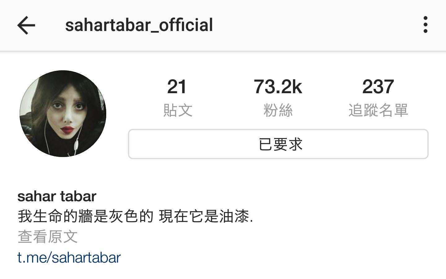 一次整形换来5次痛苦手术,朱莉做了什么手术