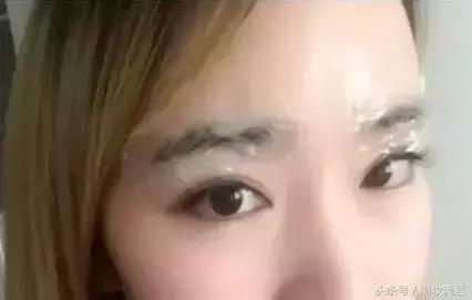 敷麻药过敏红疹一般多久自愈,麻药不敏感怎么办