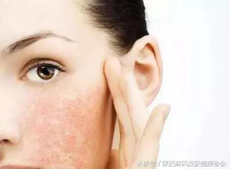 化妆品过敏了化妆品有什么责任,皮肤过敏了以后能用什么化妆品