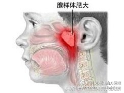 宝宝打呼噜五大原因,育儿宝宝睡眠知识