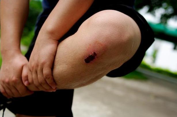 皮肤伤口难愈合是什么原因,皮肤伤口难愈合还很痒是什么原因