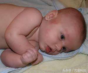 怎么辨别宝宝过敏症状,儿童过敏怎么判断过敏原