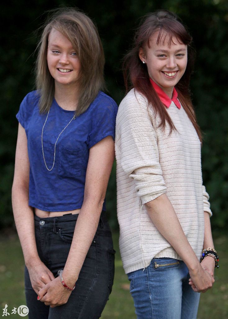 姐妹俩都患有癌症,姐妹两同时生病