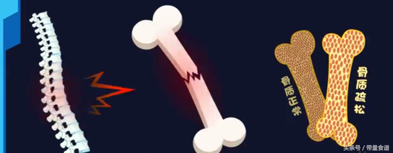 更年期会导致肿瘤高发，心梗脑梗！如何安全度过更年期？