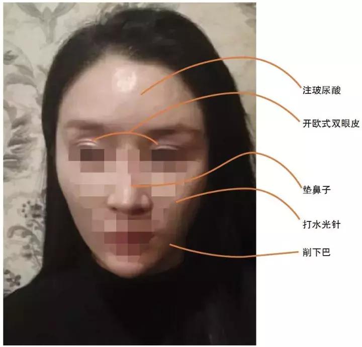 额头被别人砸了一道口子赔偿,额头被人砸开留疤能赔多少
