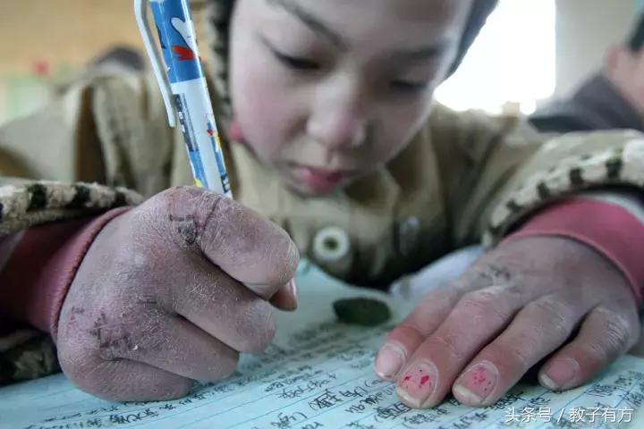 宝宝冬季冻伤,宝宝冻伤怎么治疗好得快