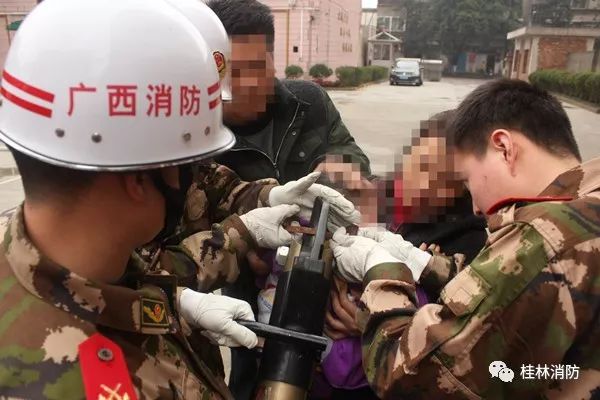 小孩不小心被卡住了,宝宝不小心被东西卡住了