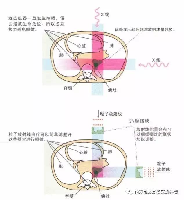 国药东风医院放疗设备,放疗最先进的放疗设备
