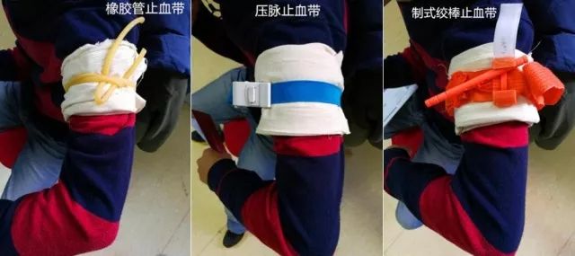 伤口出血可以用卫生巾止血吗,伤口出血怎么包扎好