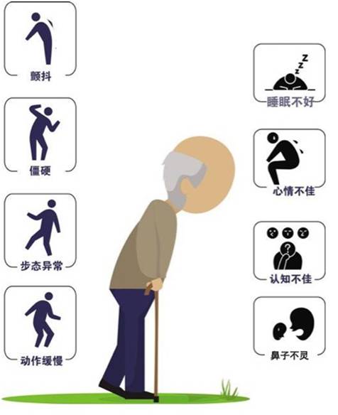 帕金森只是右手僵硬要吃药吗,帕金森只是手抖吗