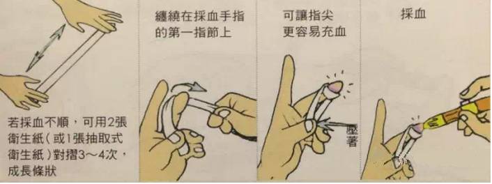 医院怎么测指尖血,测指尖血的正确方法视频