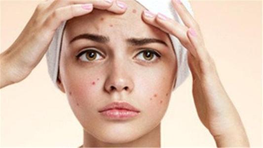 左右脸颊反复长痘痘印比较严重,左侧脸颊长痘是什么原因引起的