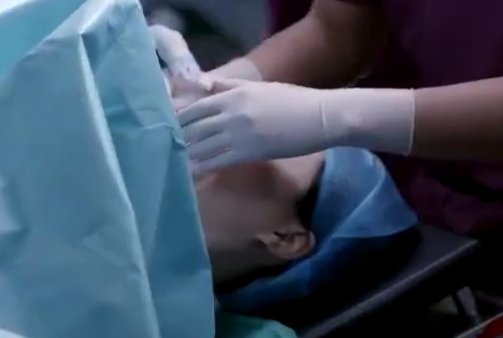 致命的“羊水栓塞”，哪来的“栓”把哪里“塞”住了