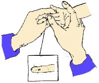 小儿肺炎发烧推拿手法,武汉极鹤小儿推拿