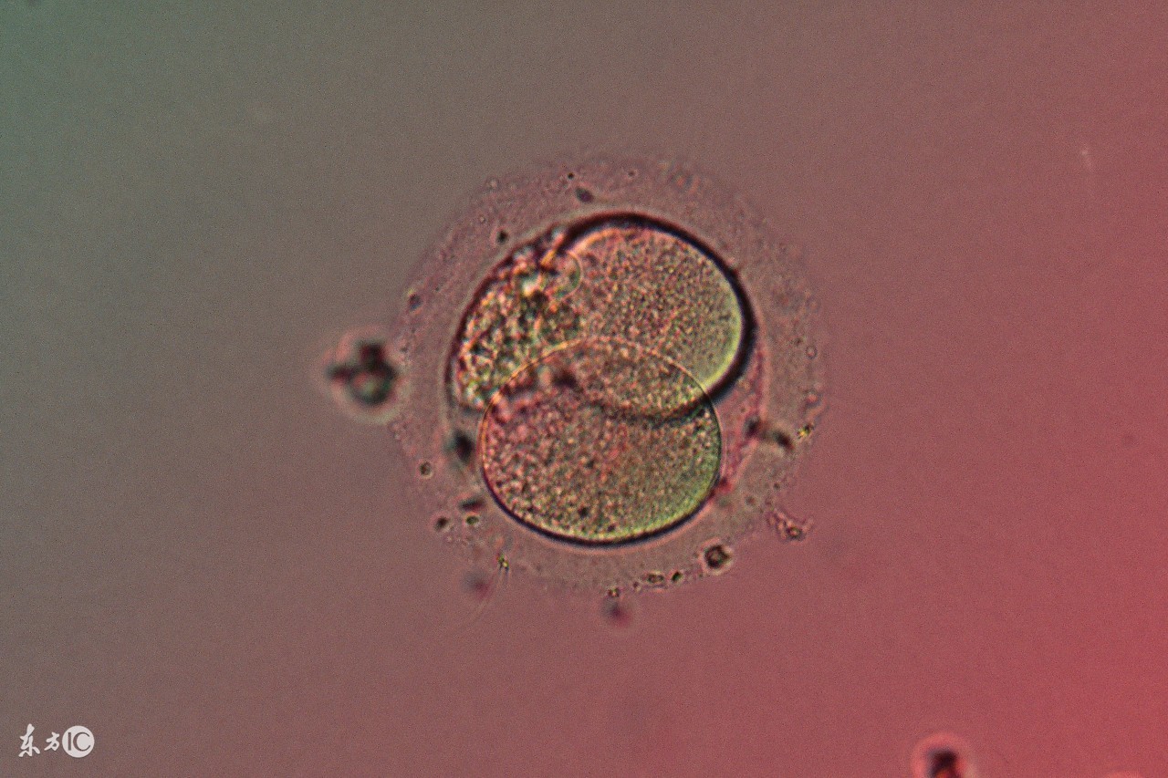 试管婴儿移植后需要关注什么么,试管婴儿移植后关注事项