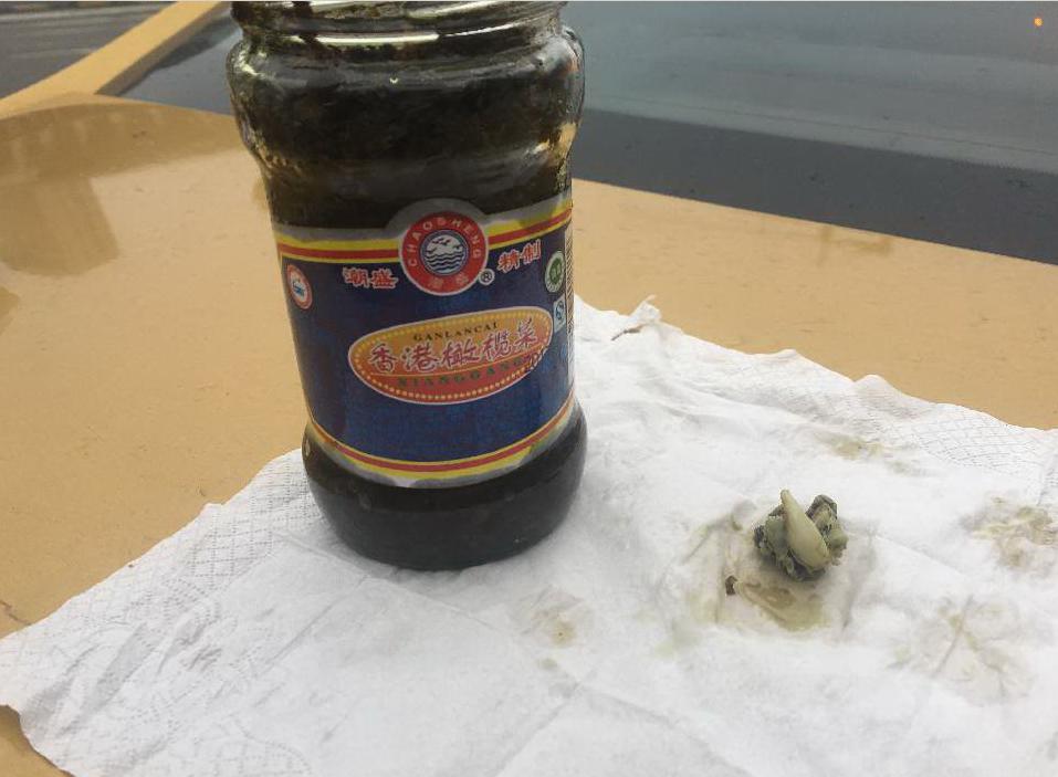 无锡消费者新买橄榄菜里竟有“獠牙”？厂家：怎么证明不是*谤诽**？