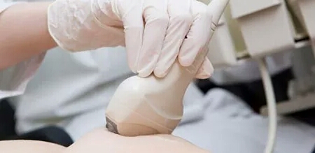 做好这三件事能避免90%的妇科疾病,赶走白带异常