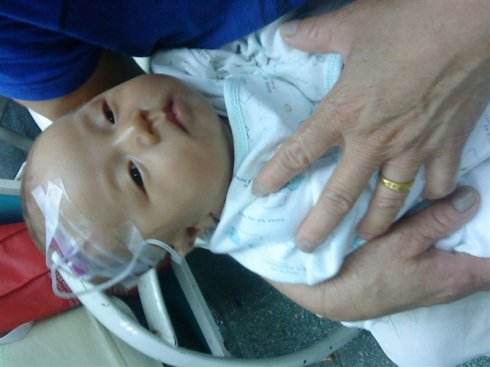 因为买衣服，10个月宝宝咳嗽发烧造成手部和腿截肢，宝妈赶快避免