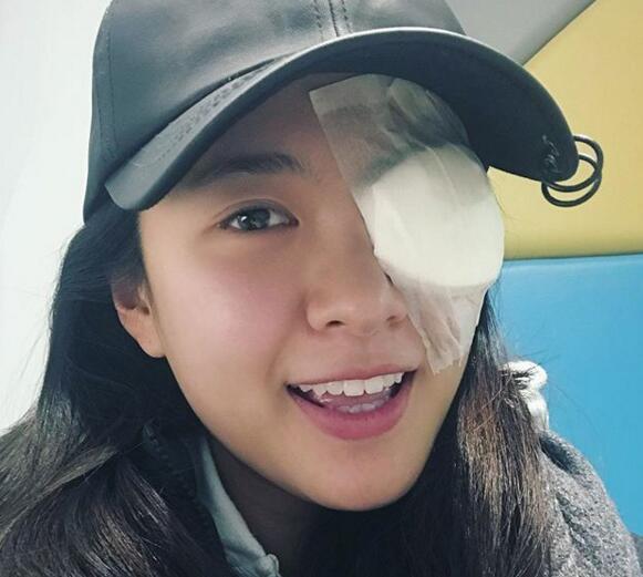 TVB美女小花生眼疮，变独眼龙但仍坚持开工，国产小鲜肉没得比！