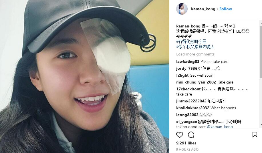 TVB美女小花生眼疮，变独眼龙但仍坚持开工，国产小鲜肉没得比！