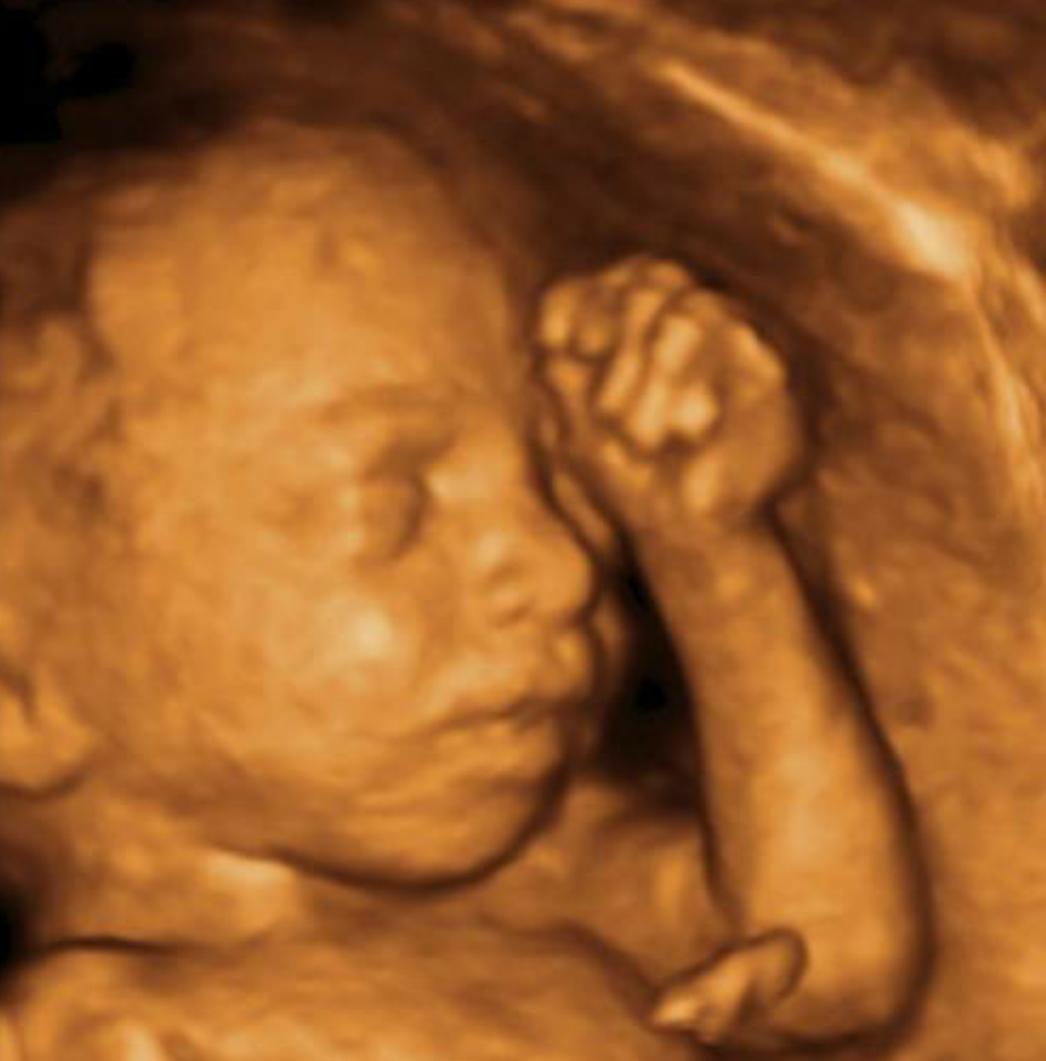 孕晚期肚子发硬怎么回事胎动多,孕晚期肚子发硬怎么回事还有腰痛