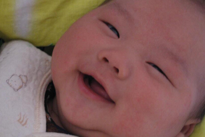 引起宝宝湿疹的原因和解决方案,宝宝容易长湿疹妈妈应该关注什么