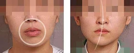 左右脸型不对称怎么矫正,怎么矫正自己的脸型