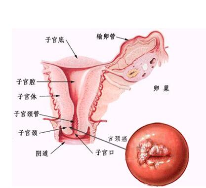 分娩开十指真有那么宽吗,自然分娩时开十指有多大
