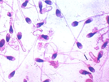 精子的组成成分是什么视频,精子的结构由什么组成